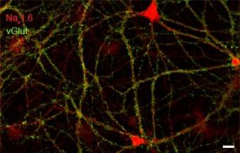 Rat hippocampal neurons (21DIV) dual immuno-labeled with Nav1.6 and vGlut. Scale bar = 200µm