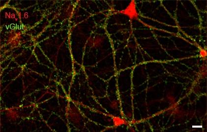 Rat hippocampal neurons (21DIV) dual immuno-labeled with Nav1.6 and vGlut. Scale bar = 200µm