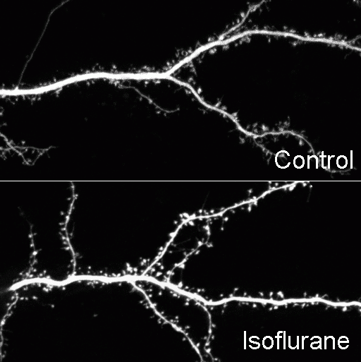 Confocal time-lapse images of GFP labeled hippocampal neurons (21 DIV) showing dendritic arbor of control (top) and isoflurane-treated (below) neurons. (from Platholi et al., 2014)