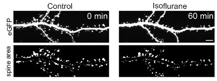 Confocal time-lapse images of GFP labeled hippocampal neurons (21 DIV) showing dendritic arbor of control and isoflurane-treated neurons (top) and corresponding thresholded overall spine area after dendrite subtraction (below). Scale bar = 5μm 