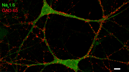 Rat hippocampal neurons (21DIV) dual immuno-labeled with Nav1.6 and GAD-65. Scale bar = 200μm.